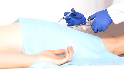 รู้จักโรคบริเวณทวารหนัก : ริดสีดวงทวาร (ตอน 3)