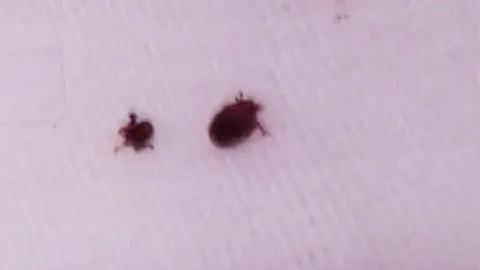 ครูเห็นผิดสังเกต เห็บสุนัขไต่ตามตัว นร. 8 ขวบ สยองดูในหู เจออีกเพียบ