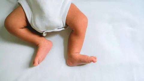 อุทาหรณ์ พ่อแม่มือใหม่ ลูกวัยเดือนเศษ นอนหนุนหัวสูง คอพับ ขาดอากาศหายใจดับ