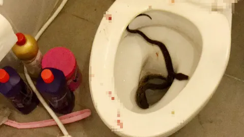 งูโผล่ชักโครก กัดของลับหนุ่ม 18 เจ็บจี๊ดเลือดสาด ส่ง รพ.เย็บ 3 เข็ม