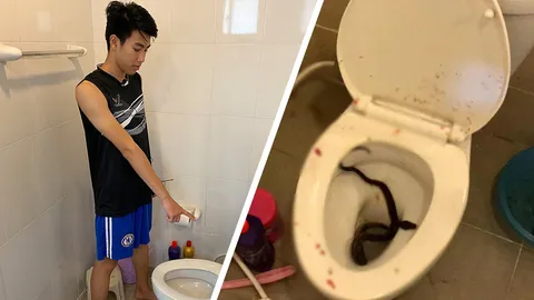 หนุ่มเทคโน เผยนาที "งูเหลือมงับจู๋" ตกใจกระชากเลือดพุ่งกระฉูด เย็บ 4 เข็ม