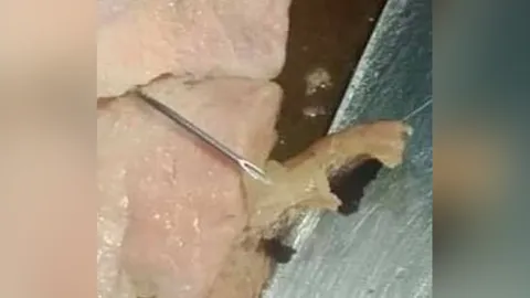 มื้ออร่อยกลายเป็นสะพรึง เจอเข็มฉีดยาในหมูย่าง หวิดทิ่มกระพุ้งแก้ม