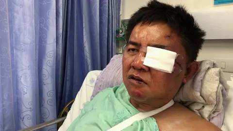 เปิดใจ "ผู้กองปูเค็ม" โดนซ้อมปางตาย เชื่อเจ้าของตู้สล็อตส่งซิกให้รุมยำ (คลิป)