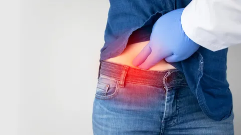 ปวดท้องแบบไหนเรียกว่า “ไส้ติ่งอักเสบ”