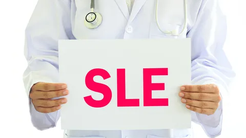 มารู้จัก “โรค SLE” กันเถอะ (ตอน 4)