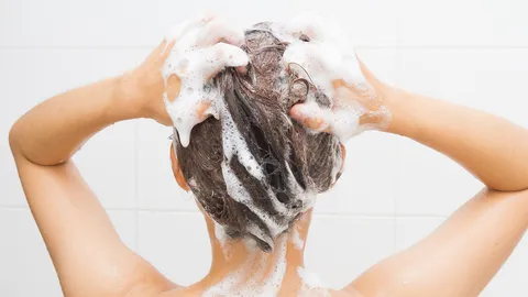 แพทย์เตือน "ยาคุมกำเนิด" บดใส่แชมพู ไม่สามารถช่วยรักษา "โรคผมร่วง" ได้