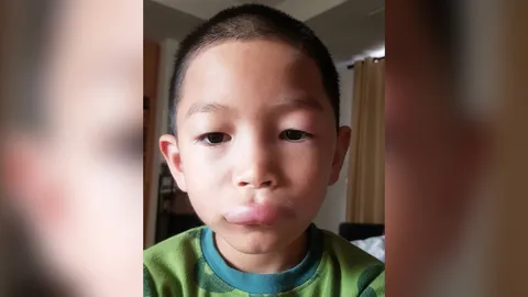 หัวอกแม่ พลอย ตกใจ น้องพูม่า ปากบวม รีบพาหาหมอก่อนตามล่าเจ้าวายร้าย