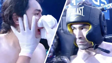 แน็ก ชาลี แพ้น็อกถึงเลือดเดือดชก เจมส์ 10 Fight 10 แมทธิว ต้องโยนผ้าขาว