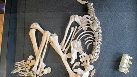 ไขที่มา ของบุรุษยุคเหล็กผู้ป่วยวัณโรค