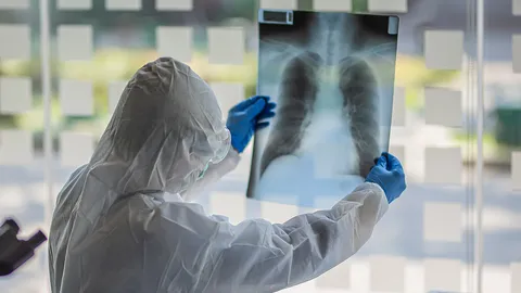 คอมพิวเตอร์เรียนรู้ตนเอง ช่วยวินิจฉัยโควิด-19