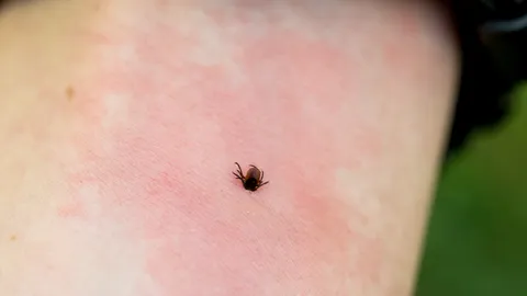 แมลงป่วนเรือดำน้ำลับ