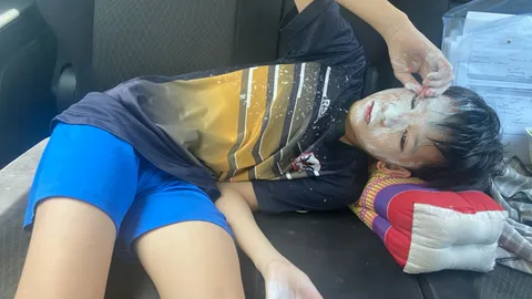 น้ำยาลบคำผิดระเบิดใส่หน้า ด.ช.10 ขวบ ยังดีบาดเจ็บเล็กน้อย แต่ล้างไม่ออก