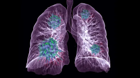 รู้จัก "อาการโควิดเดลตาเบื้องต้น” ป้องกันการแพร่เชื้อระยะฟักตัว