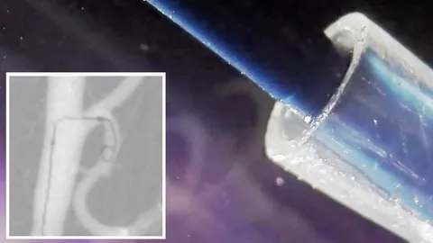 พัฒนาสายท่อควบคุมทิศทางใช้สำหรับสมอง