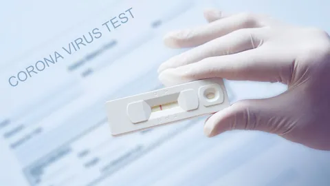 เตรียมแล็บสุ่มตรวจคุณภาพ ATK ย้ำต้องผ่านการทดสอบจึงกระจายออกได้