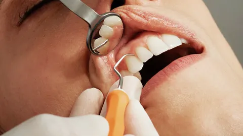 รู้จักอาการ "เหงือกบวม" อักเสบแบบไหน ควรไปพบแพทย์?