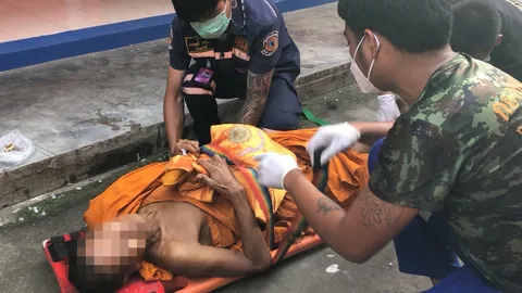 พระฉันเห็ดพิษ เก็บมากินแบบสดๆ ถึงกับอาเจียนเป็นเลือด 