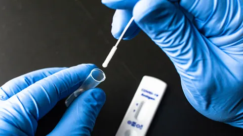 ได้รับ ATK แล้ว วอนรีบตรวจ-แจ้งผล บริษัทประกันโละพนักงาน เอามาจ่ายสินไหม