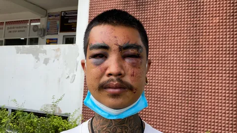 โหดแท้ แค่บีบแตร 2 ที โดนรุมยำเละ เมียเห็นจำแทบไม่ได้ 