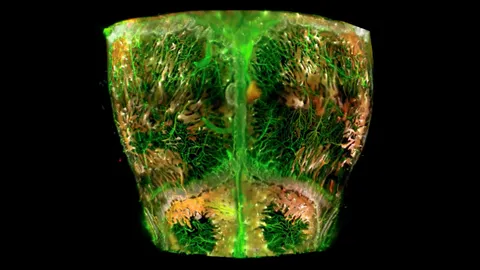 แผนที่ 3 มิติของหลอดเลือดและเซลล์ต้นกำเนิดในกะโหลกศีรษะ