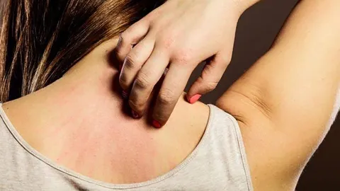 ปลดล็อกโรคอ้วน... ลดเสี่ยงโรคผิวหนัง