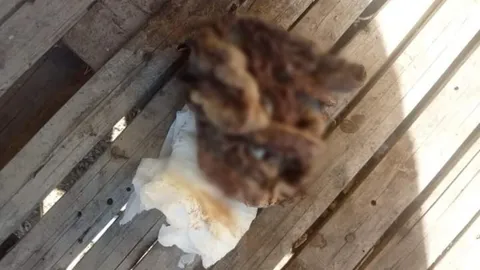 โรงพยาบาลแจง สาวโพสต์ประสบการณ์หลังคลอด เจอผ้าก๊อซยาวเป็นเมตรในช่องคลอด