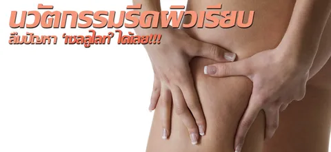 นวัตกรรมรีดผิวเรียบ ลืมปัญหา'เซลลูไลท์'ได้เลย!!!