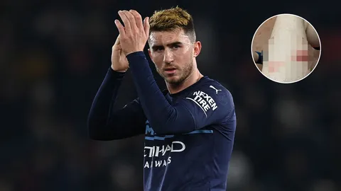 ของแถมชั้นดี  "ลาปอร์เต" โชว์รอยแผล หลังช่วย "แมนฯ ซิตี้" บุกเจ๊า "เซาแธมป์ตัน"