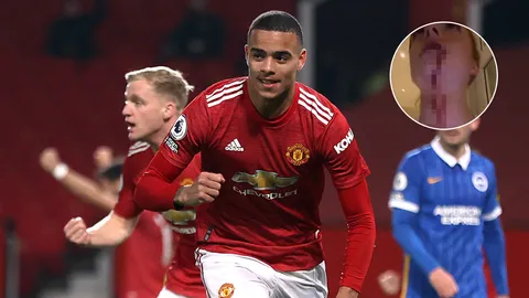 “กรีนวูด” ส่องานเข้า แฟนสาวโพสต์ภาพ-คลิปออกสื่อหลังโดนทำร้าย