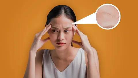 หน้าผากเป็นแผล โหงวเฮ้งไม่ดี ส่งผลอย่างไรต่อชีวิต