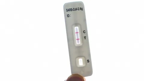 นักวิทย์จีนพัฒนาชุดตรวจโควิด-19 รู้ผลแม่นยำภายใน 4 นาที