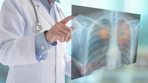 สวทช.พัฒนา “เครื่องเอกซเรย์ปอด” สู้โควิด