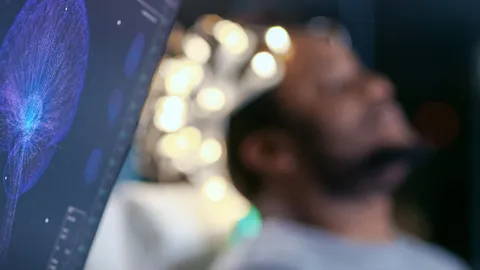 “การรักษาทางจิตเวชด้วยไฟฟ้า” ทางเลือกหนึ่งในการรักษาผู้ป่วยจิตเวช