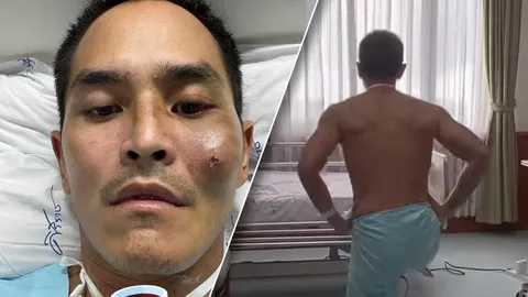 สงกรานต์ ปั่นจักรยาน เกิดอุบัติเหตุร้าย ชนกับรถยนต์ 
