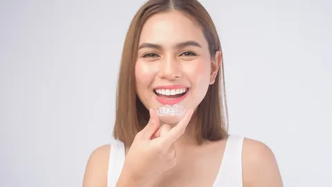 รู้จักวิธี "จัดฟันแบบใส (Invisalign)" ที่ดารานิยมกัน