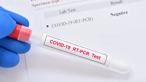 คาดต่างชาติมาแน่ 10 ล้านคน เลิก RT-PCR ปลุกเดินทาง-ค้าขายคึกคัก