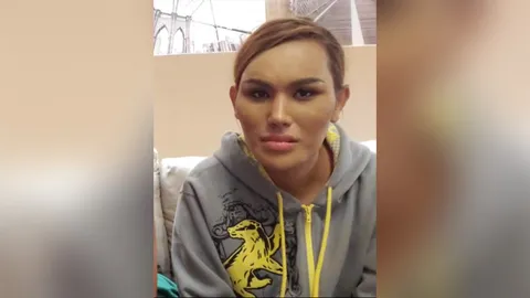 แอนนา ทีวีพูล เครียดคดี แตงโม พบจิตแพทย์ กินยานอนหลับมากไป จนลิ้นแข็ง 