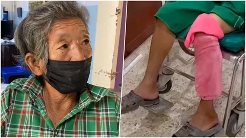 ยายวัย 64 คนหากุ้ง โดนไอ้เข้งับขาเป็นแผลลึก เตือนคนริมน้ำบางปะกงระวัง