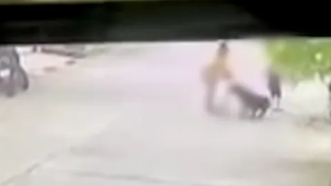 แชร์ว่อน คลิปนาทีสุนัขพันธุ์ใหญ่ หลุดขย้ำเด็ก 2 ขวบ เย็บ 200 เข็ม