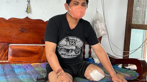 หนุ่มแชมป์ลาเต้อาร์ต ชีวิตพลิก ถูกลูกนายตำรวจ ขับรถชนขาขาด 