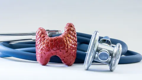 เปิดสาเหตุ "ไทรอยด์เป็นพิษ" เกิดจากอะไร อันตรายถึงชีวิตหรือไม่ ป้องกันได้หรือเปล่า