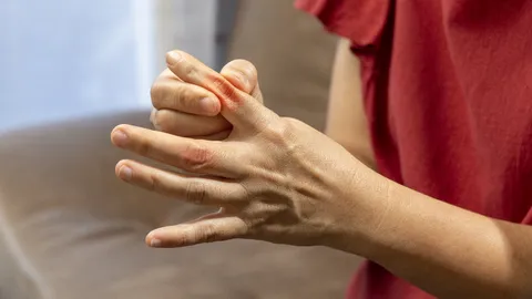 ฝันว่านิ้วขาด ดีหรือร้าย อ่านคำทำนายพร้อมเลขเด็ด