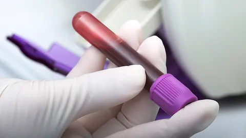 เลือดเป็นกรด...โรคธรรมดาที่ทำให้เสียชีวิตได้