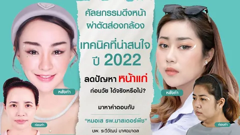 ศัลยกรรมดึงหน้าผ่าตัดส่องกล้อง เทคนิคที่น่าสนใจ ปี 2022 ลดปัญหาหน้าแก่ก่อนวัย ได้จริงหรือไม่?