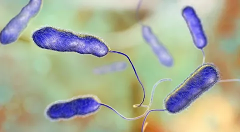 อาร์เจนตินา เผย โรคปอดบวมปริศนา คือโรคลีเจียนแนร์