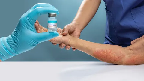 ขอรับเยียวยาแพ้วัคซีนโควิด ไม่พิสูจน์ถูก-ผิด จ่ายสูงสุดไม่เกิน 4 แสนบาท