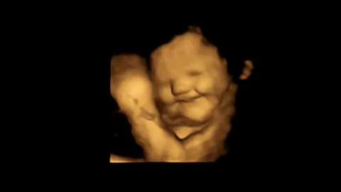 สุดทึ่ง ผลศึกษาใหม่อังกฤษ พบแม่ตั้งครรภ์ กินแครอท ทำทารกยิ้มอารมณ์ดี