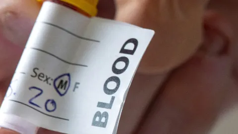 นักวิทย์สิงคโปร์พัฒนาชุดตรวจเลือด วัดภูมิคุ้มกันโควิดได้ใน 10 นาที