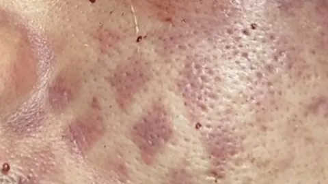 วัยรุ่นรุมยำหนุ่มลี้ปางตาย จนหน้าเป็นรอยรองเท้า ตำรวจเร่งเช็กวงจรปิด