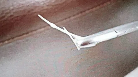 หมอเตือน "ก้างปลาติดคอ" อย่ากลืนข้าวปั้นตาม เสี่ยงลึกกว่าเดิม